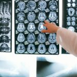 Memoria en pausa: cómo el cerebro borra lo que no usas